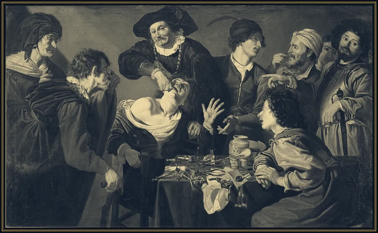 Obraz „Wyrywacz zębów” Theodoora Romboutsa z około 1628 roku: cyrulik wyrywa ząb skrzywionemu z bólu pacjentowi w otoczeniu gapiów.
